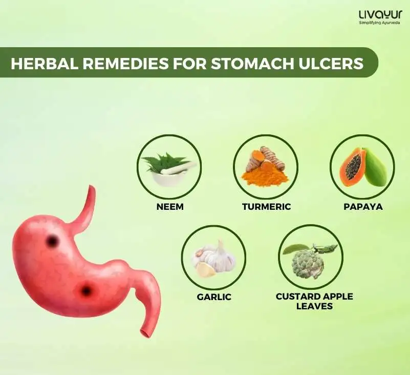 Science Backed Ayurvedic Remedies For The Treatment Of Stomach Ulcers 1