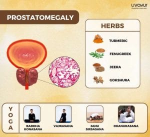 Stages of Prostatomegaly Thumbnail 1