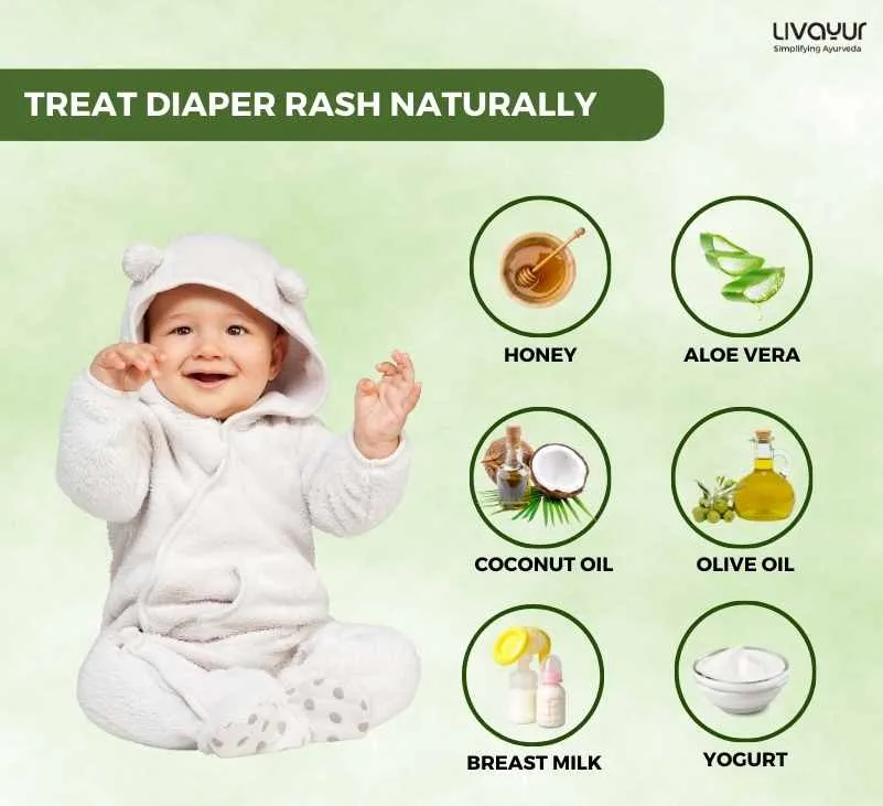 Treating Diaper Rash in Babies Naturally