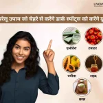 5 घरेलू उपाय जो चेहरे से करेंगे डार्क स्पॉट्स को करेंगे दूर 1