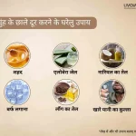 मुंह के छाले दूर करने के घरेलु उपाय 1 26