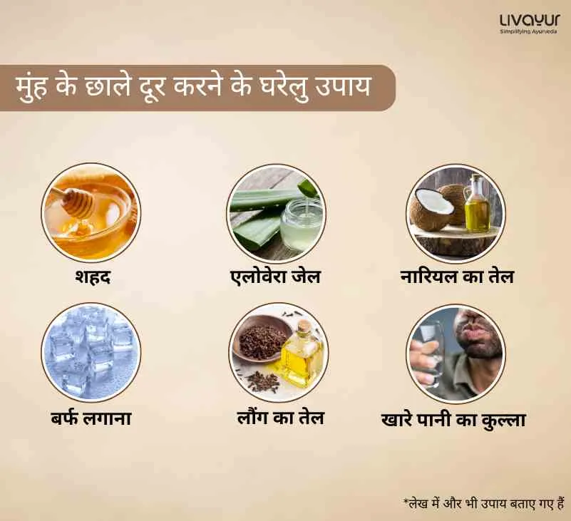मुंह के छाले दूर करने के घरेलु उपाय 1 26